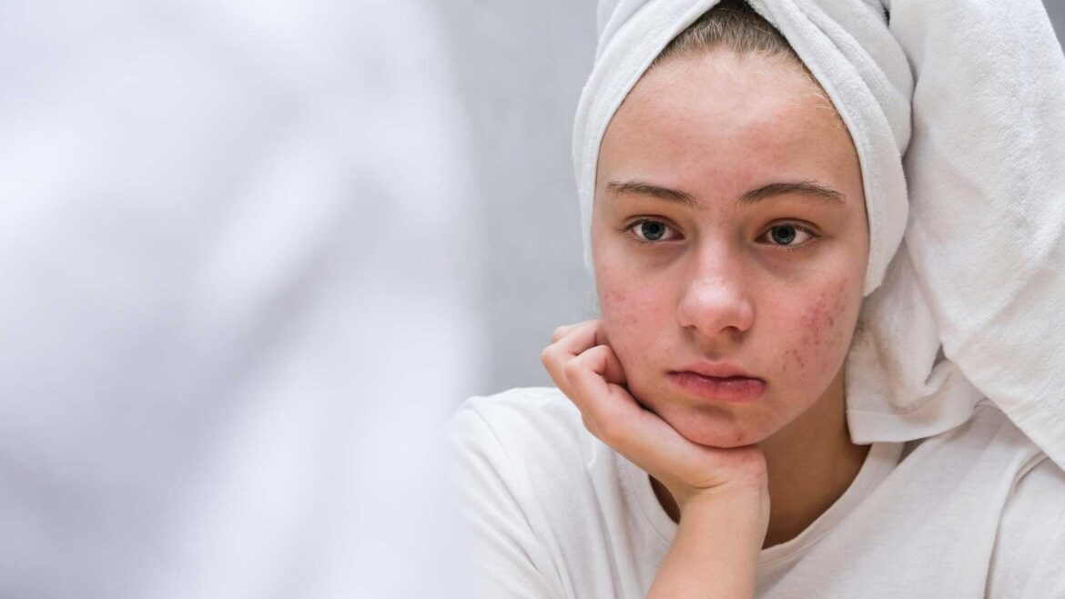 Habits that are damaging your skin.